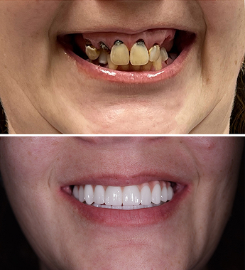 Before After Image