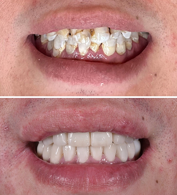 Before After Image