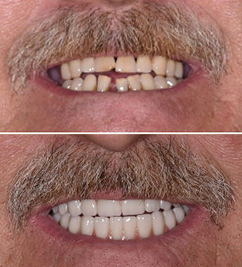 Before After Image